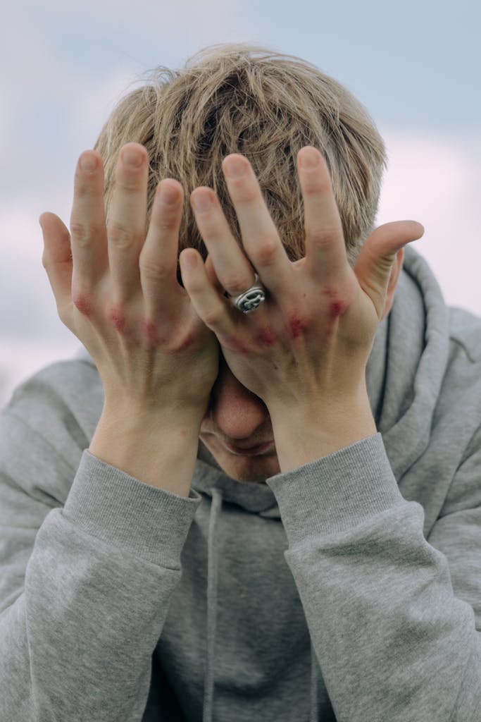 A man in a hoodie covers his face, showing bruised knuckles in an outdoor setting.